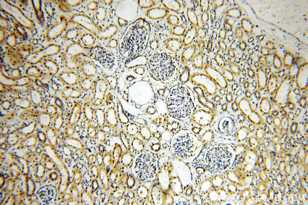 IHC staining of human kidney using 20162-1-AP