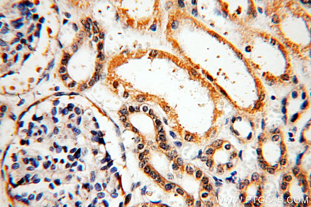 IHC staining of human kidney using 20162-1-AP