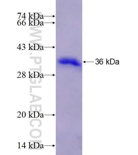 KLHL38 fusion protein Ag28165 SDS-PAGE