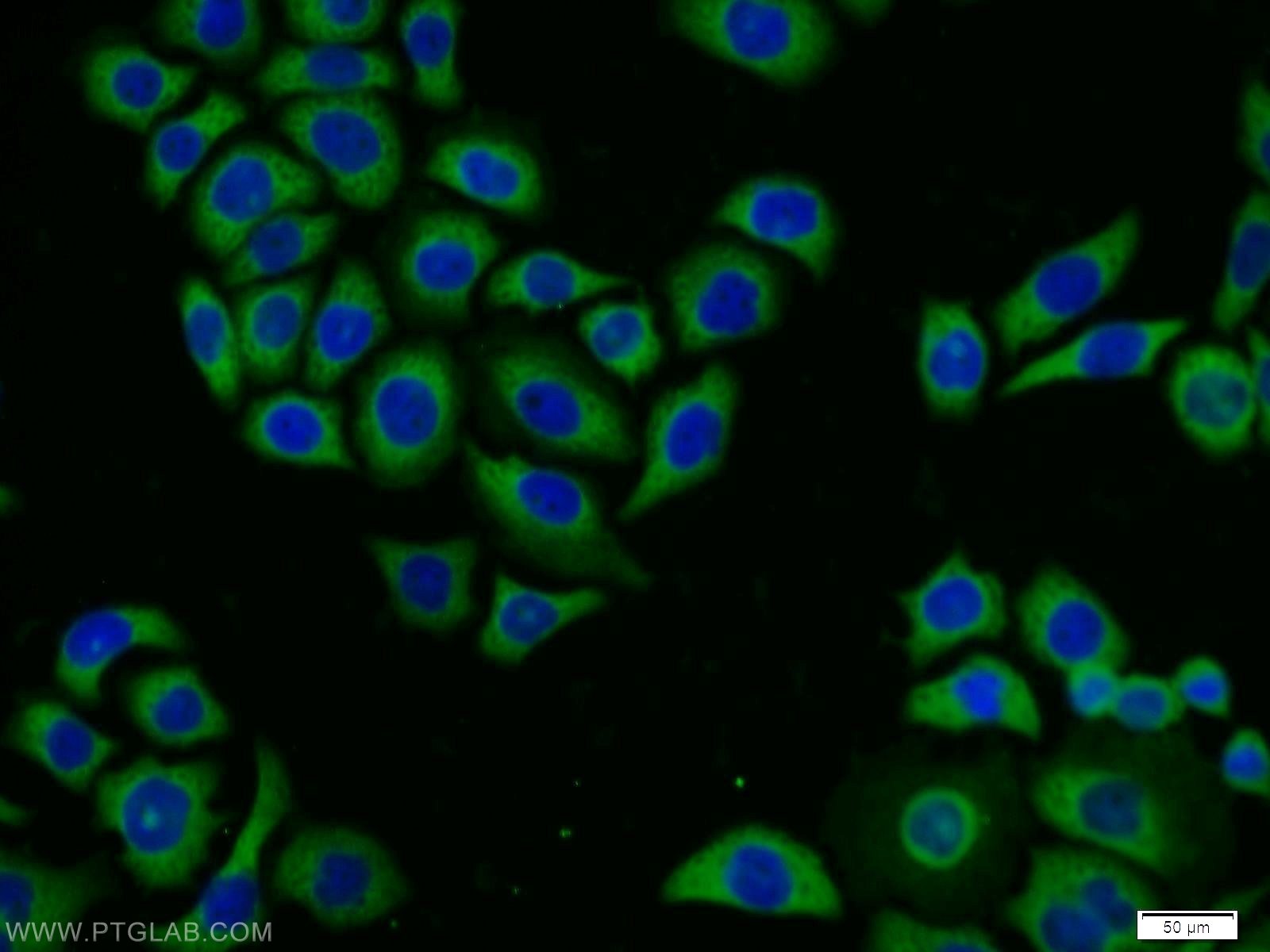 IF Staining of PC-3 using 12698-1-AP