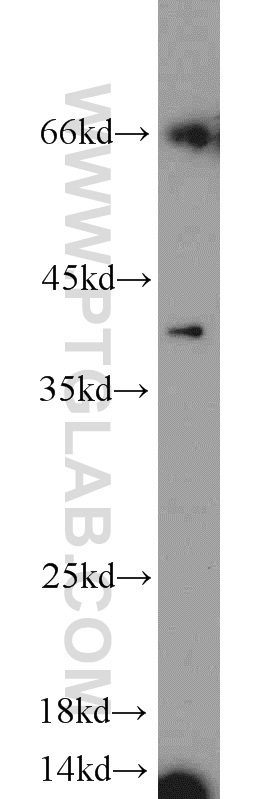 WB analysis of MCF-7 using 12698-1-AP