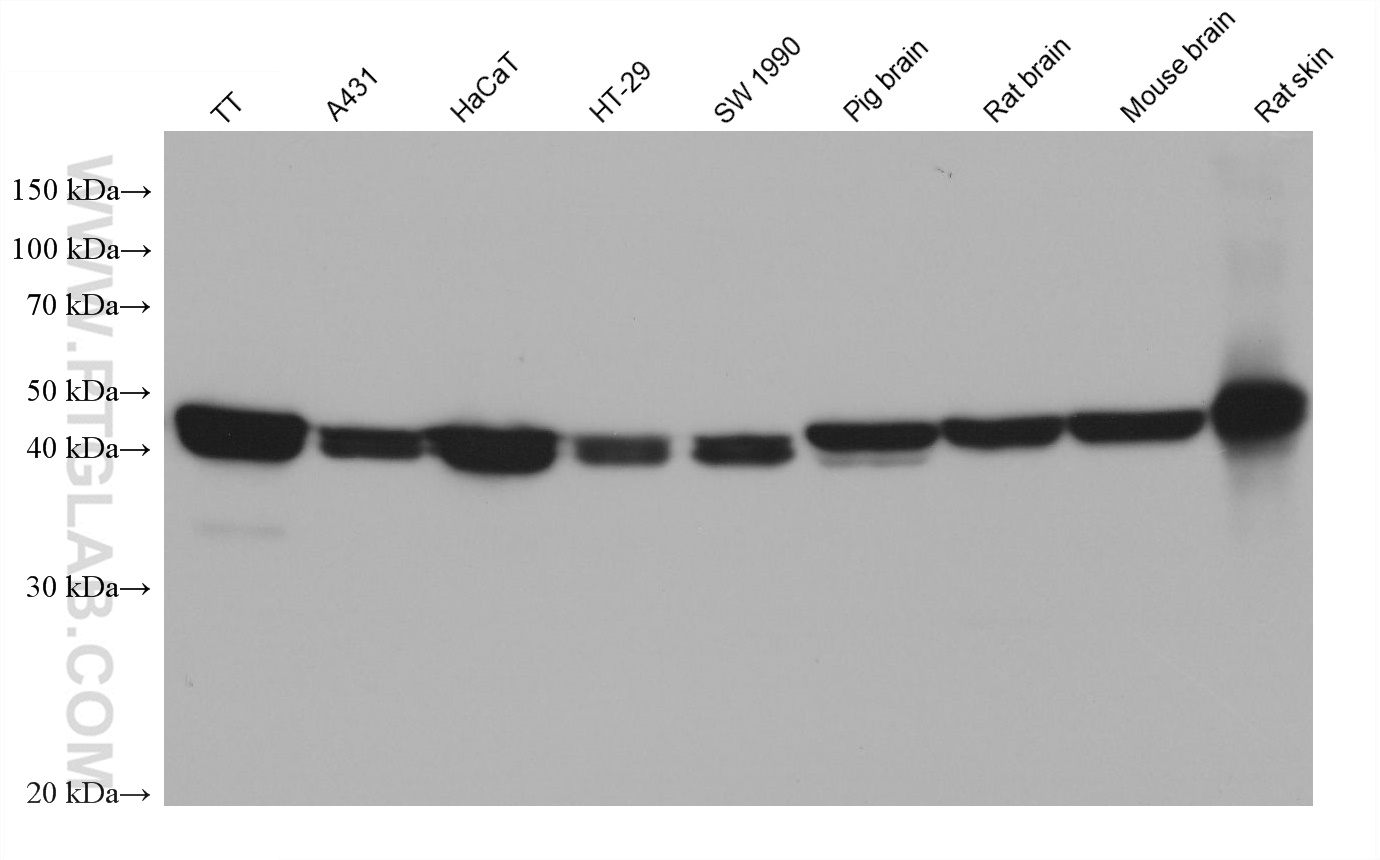 WB analysis using 67427-1-Ig (same clone as 67427-1-PBS)