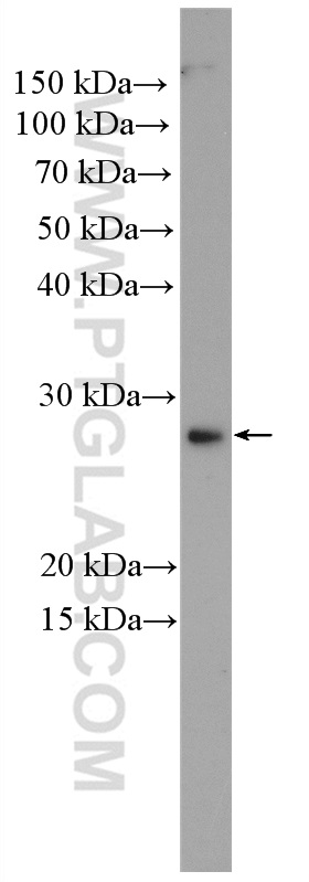 WB analysis of SMMC-7721 using 27515-1-AP