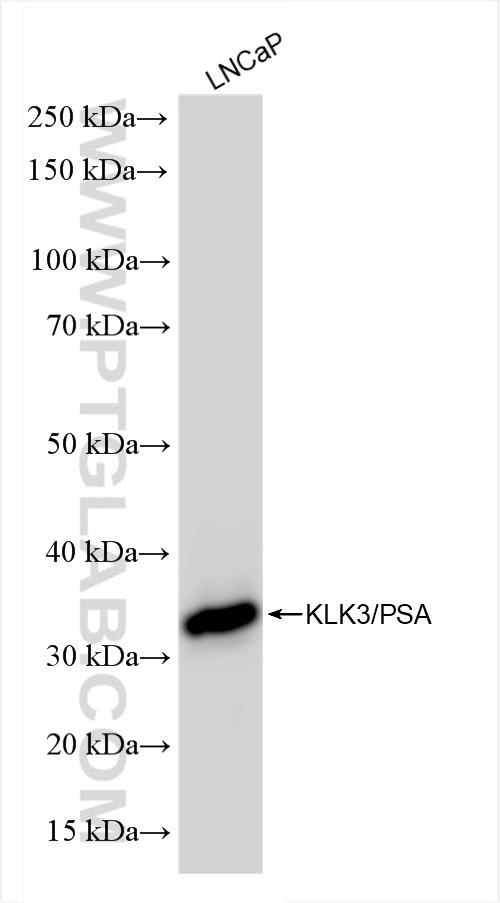 WB analysis of LNCaP using 84059-7-RR