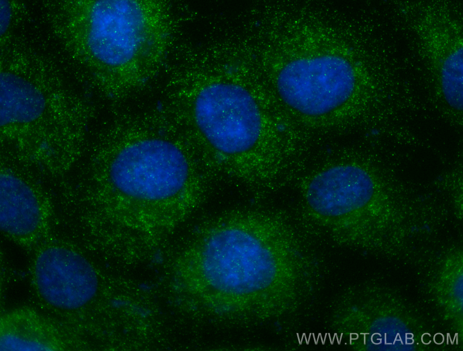 IF Staining of A431 using 23810-1-AP