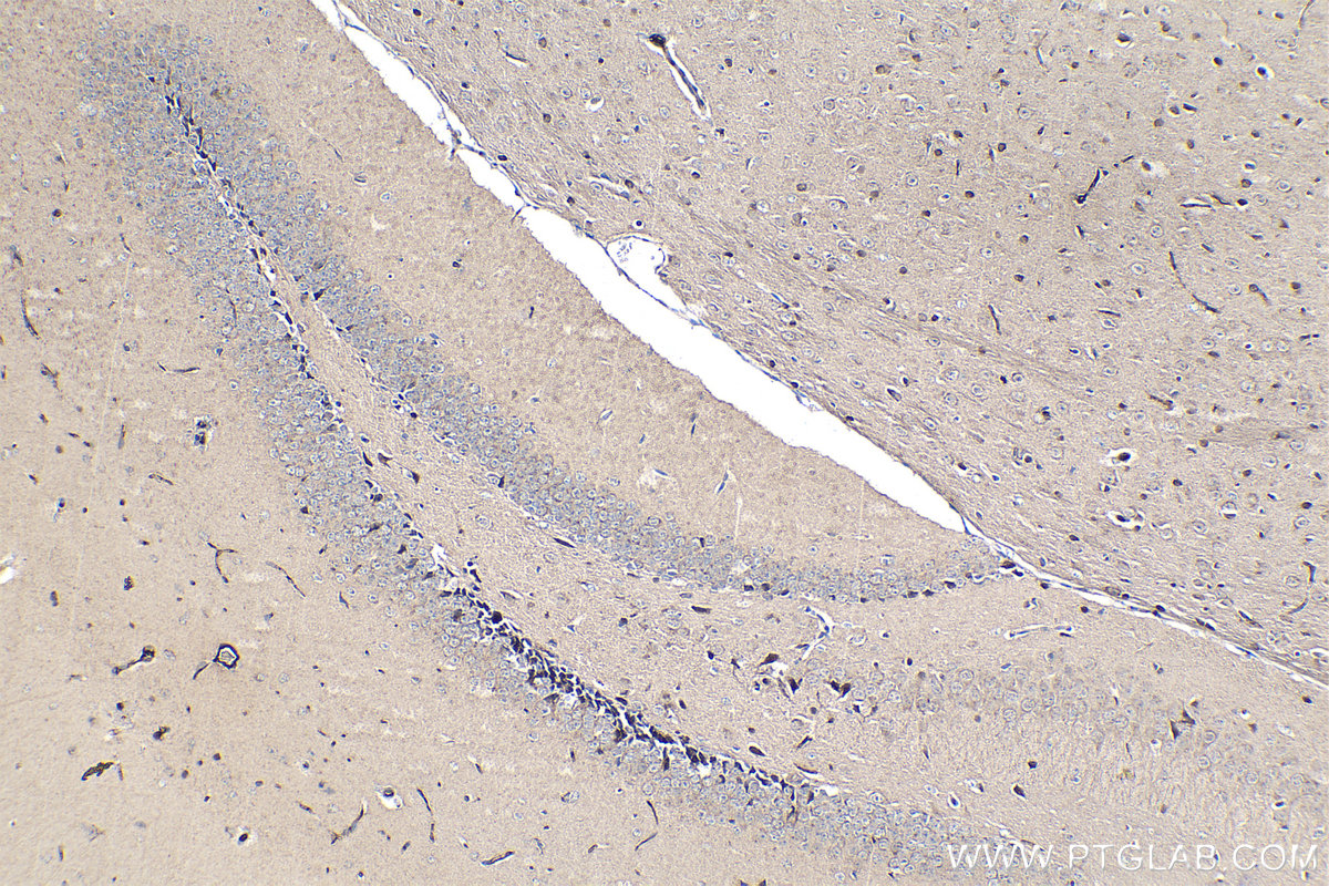 IHC staining of mouse brain using 68247-1-Ig