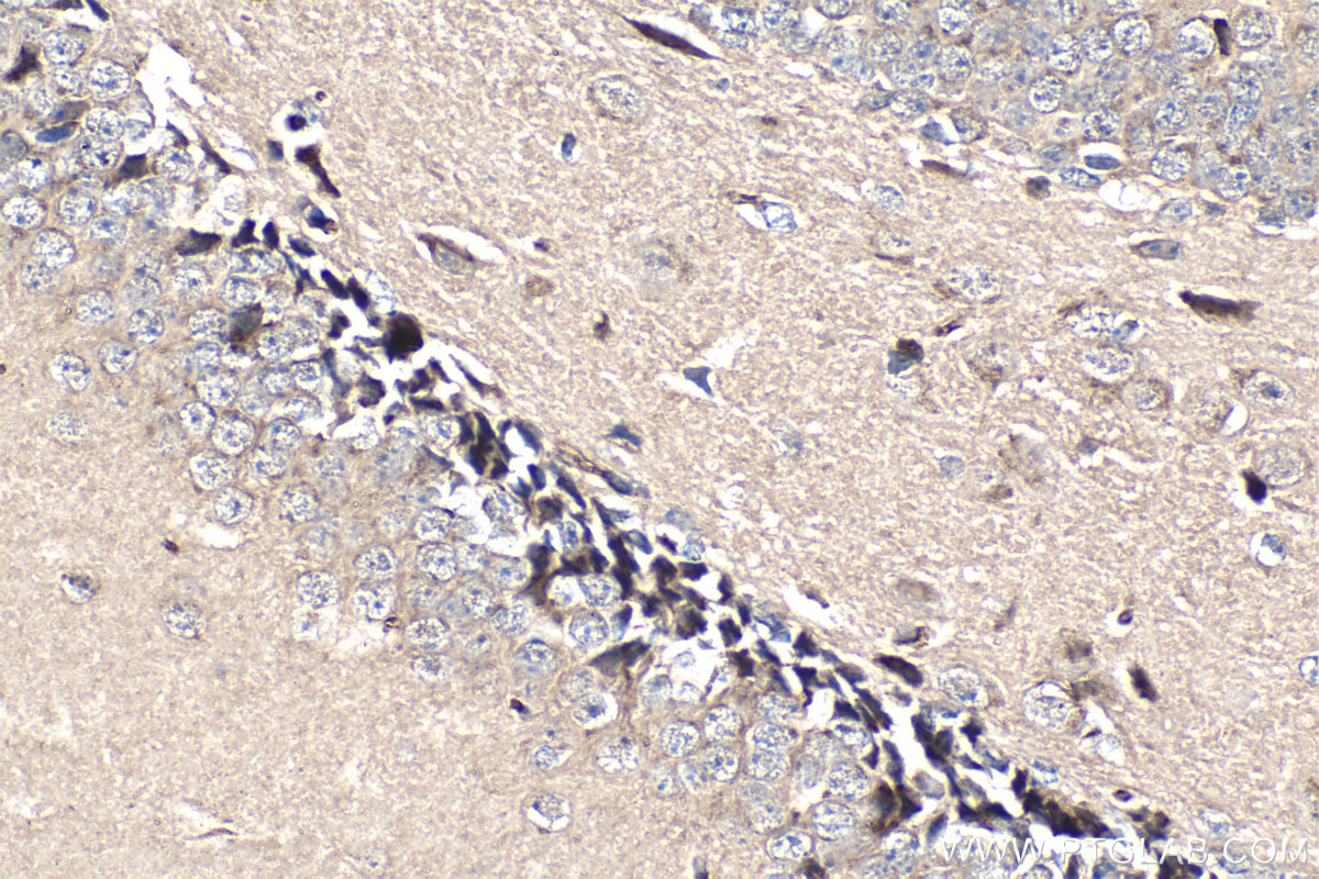 IHC staining of mouse brain using 68247-1-Ig