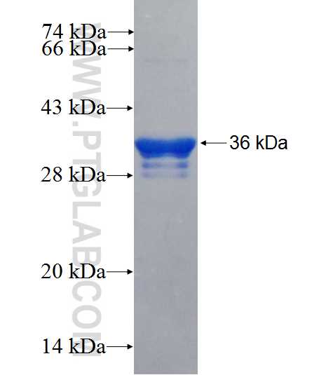 KMT2A fusion protein Ag26759 SDS-PAGE