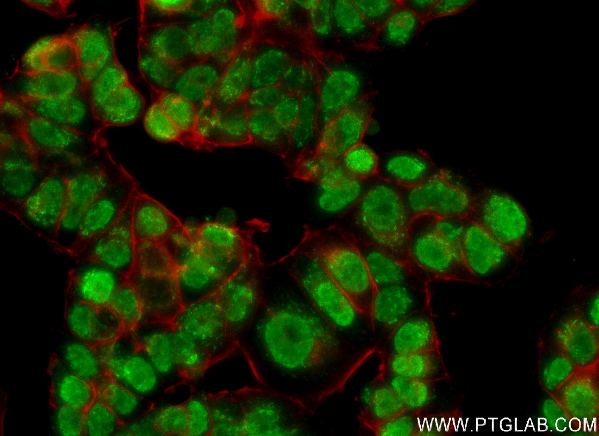 IF Staining of MCF-7 using 83595-4-RR