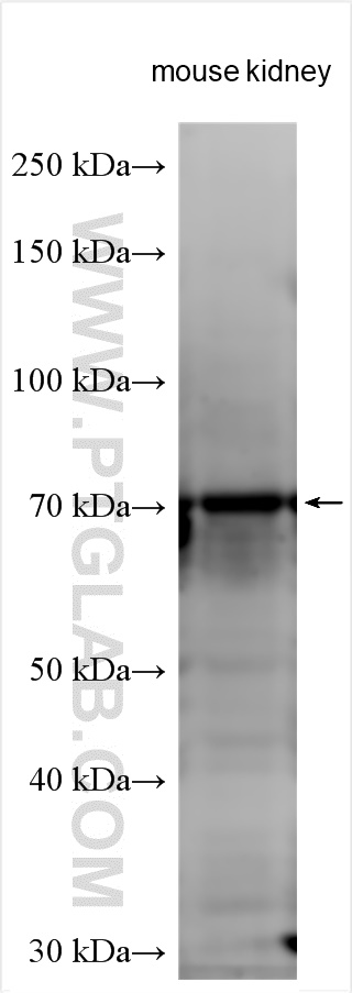 WB analysis using 11926-1-AP