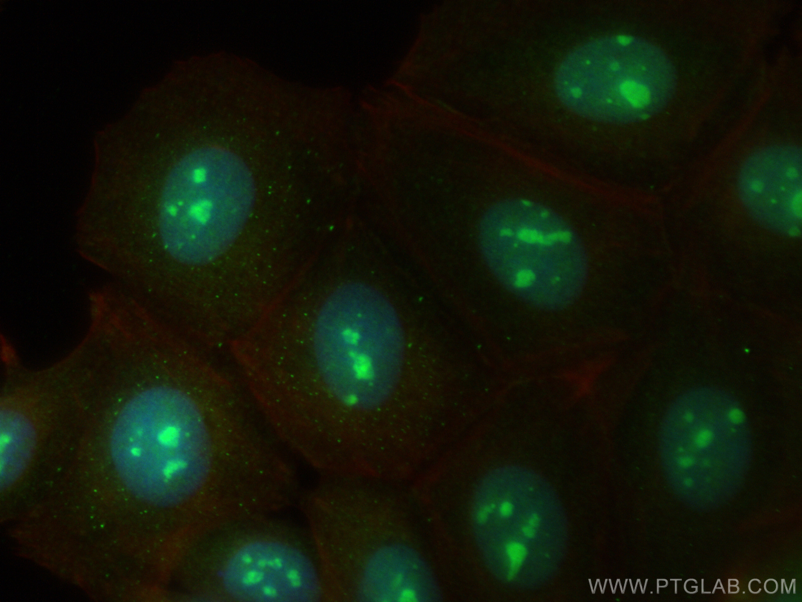 IF Staining of MCF-7 using 30115-1-AP