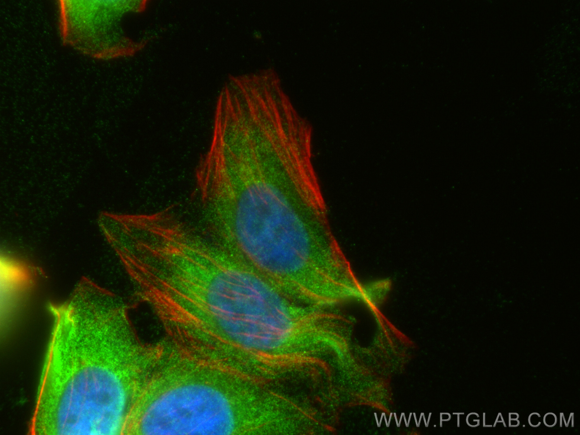 IF Staining of HepG2 using 10819-1-AP