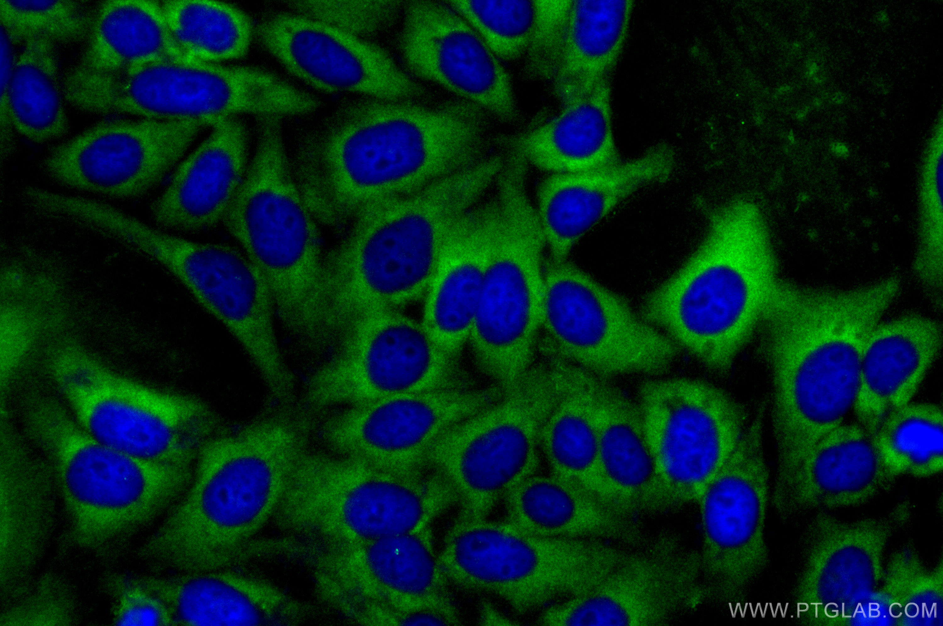 IF Staining of HepG2 using 28050-1-AP