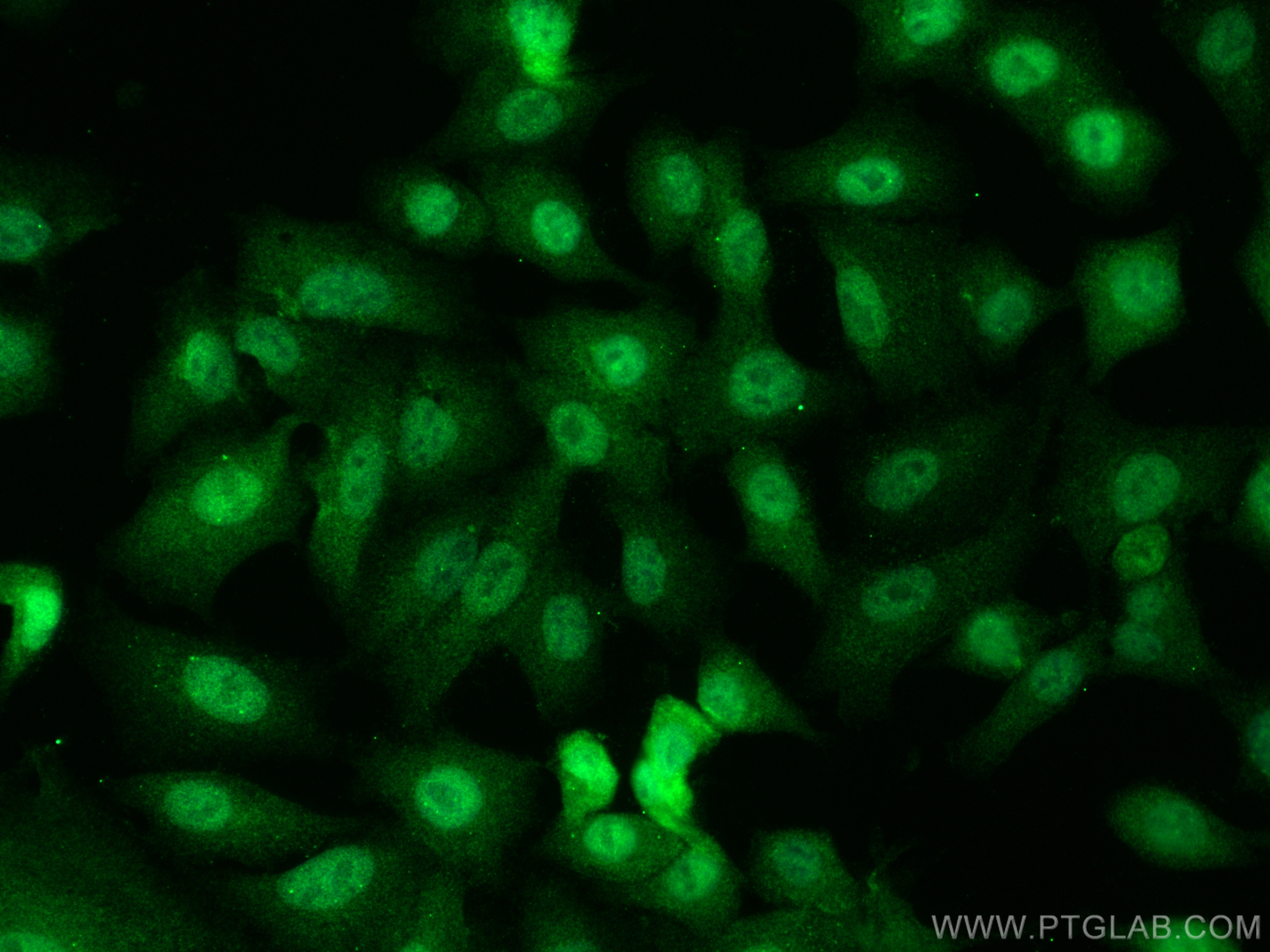 IF Staining of A549 using 12463-1-AP