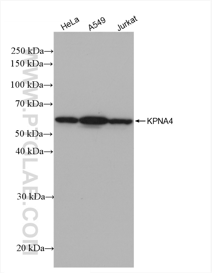 WB analysis using 82898-1-RR