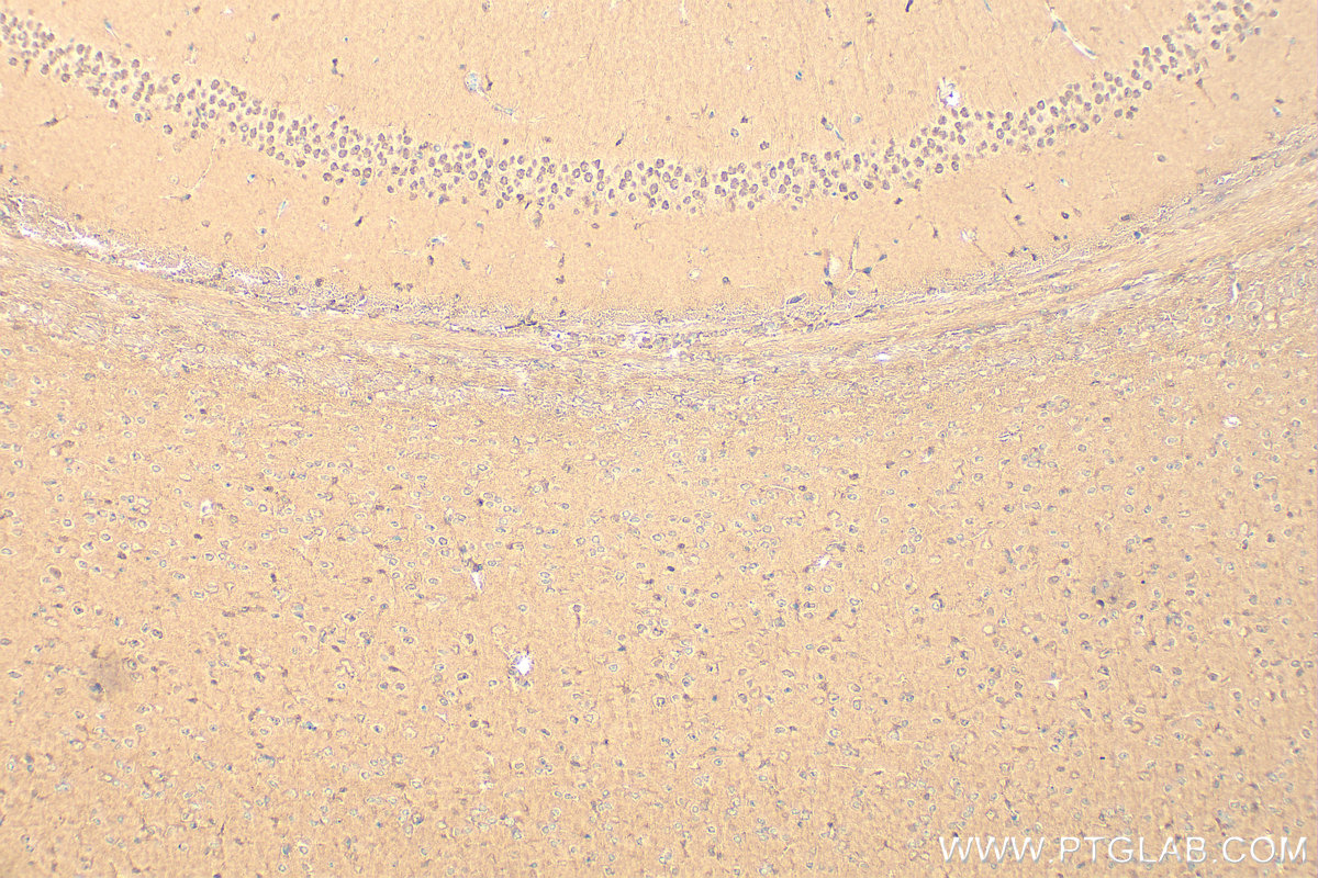 IHC staining of mouse brain using 10077-1-AP