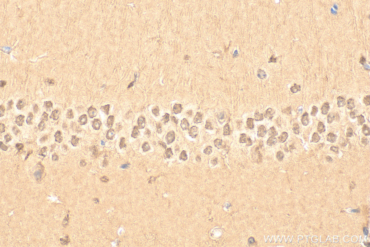 IHC staining of mouse brain using 10077-1-AP