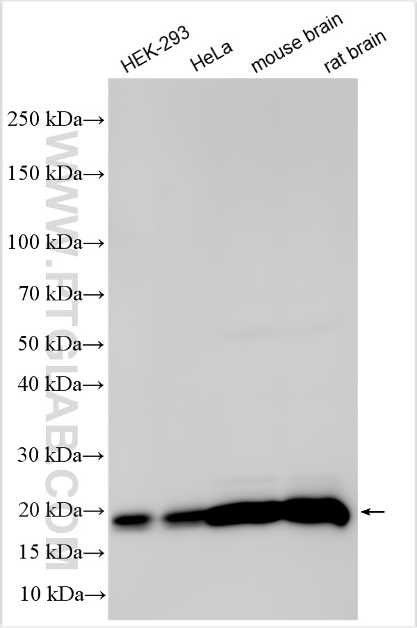 WB analysis using 12063-1-AP