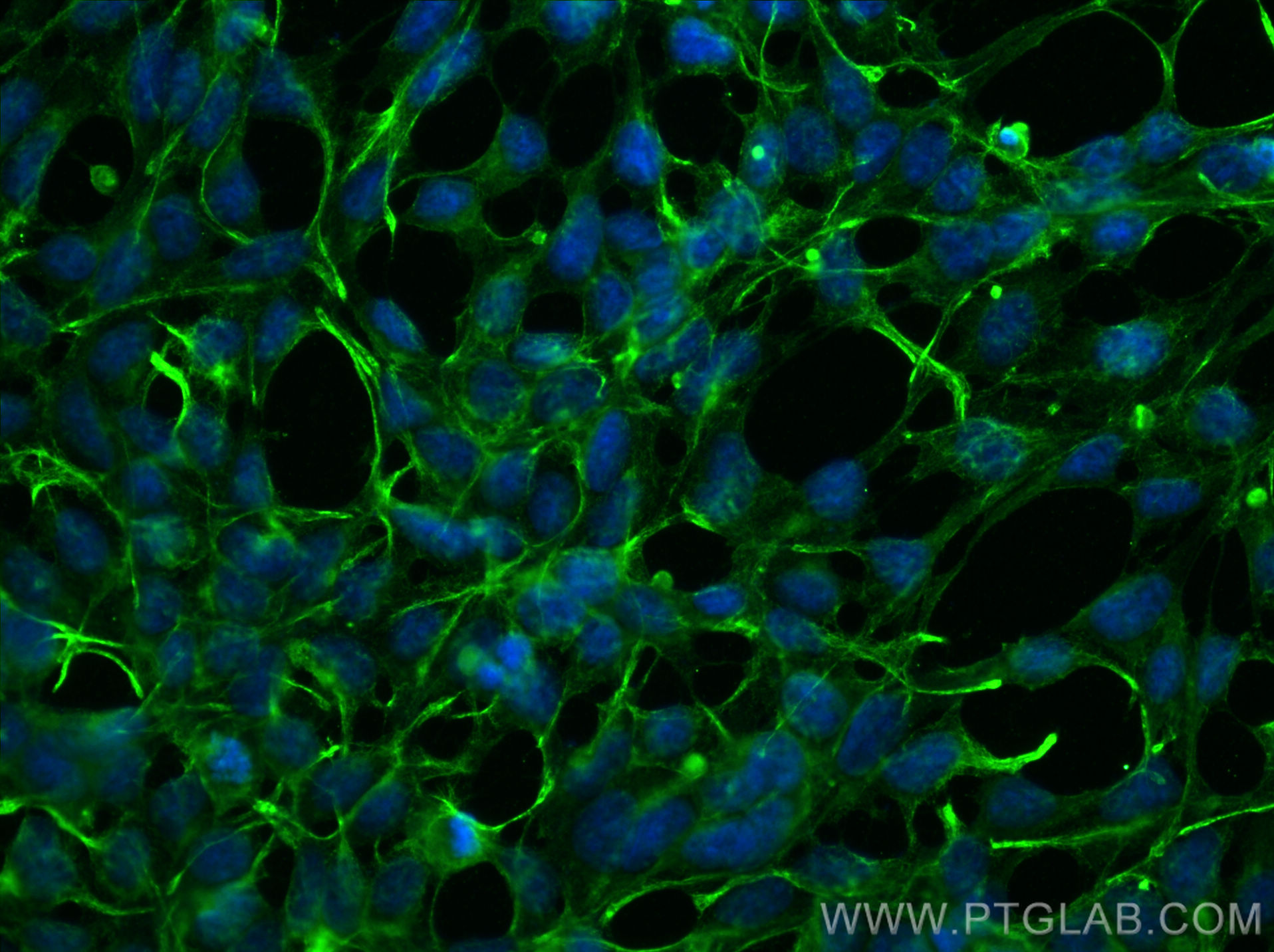 IF Staining of HEK-293 using 60309-1-Ig