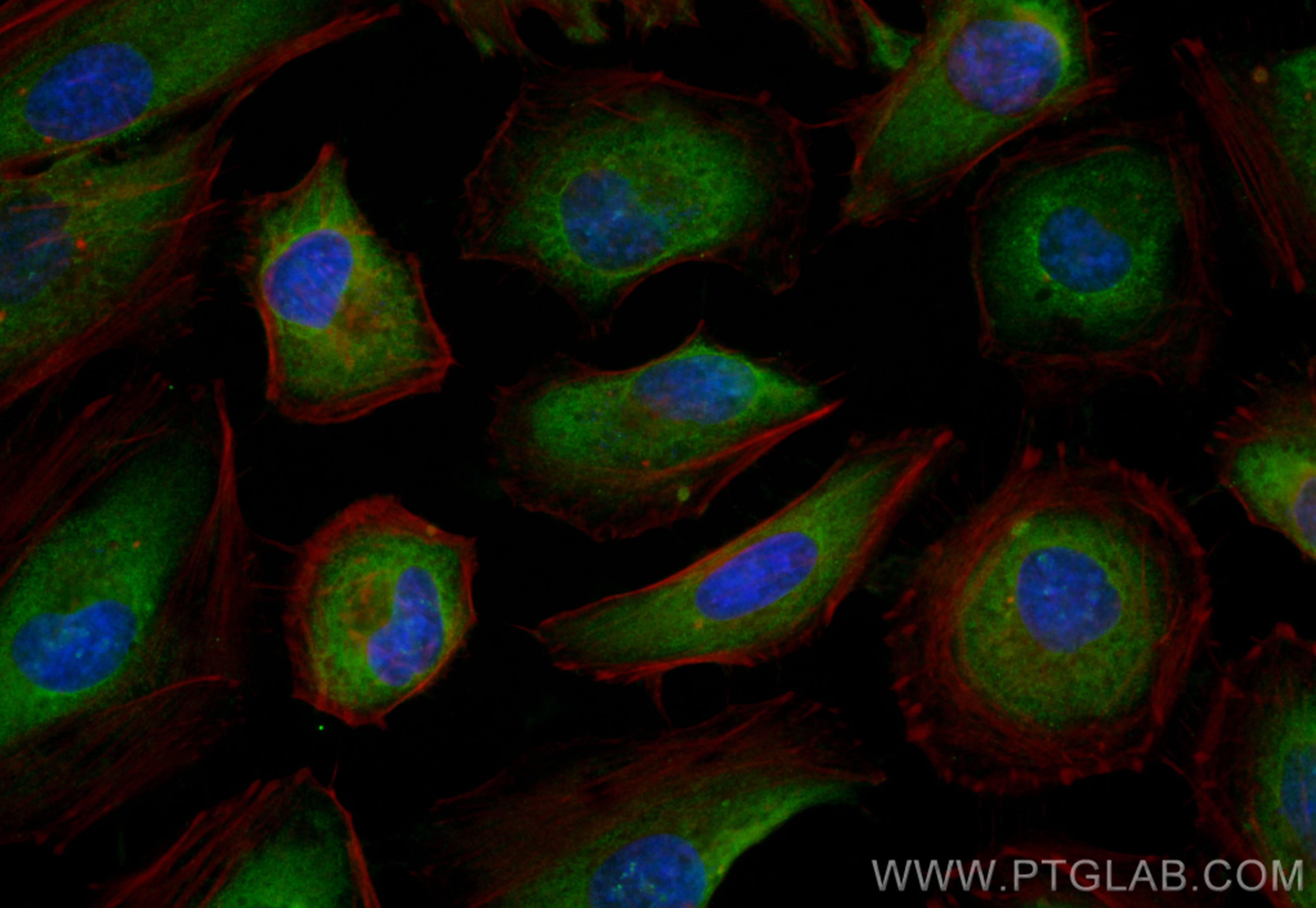 IF Staining of HeLa using CL488-12063