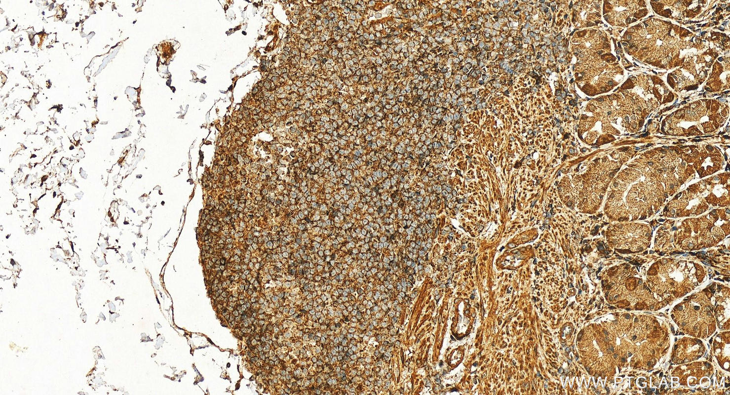 IHC staining of human stomach using 16156-1-AP