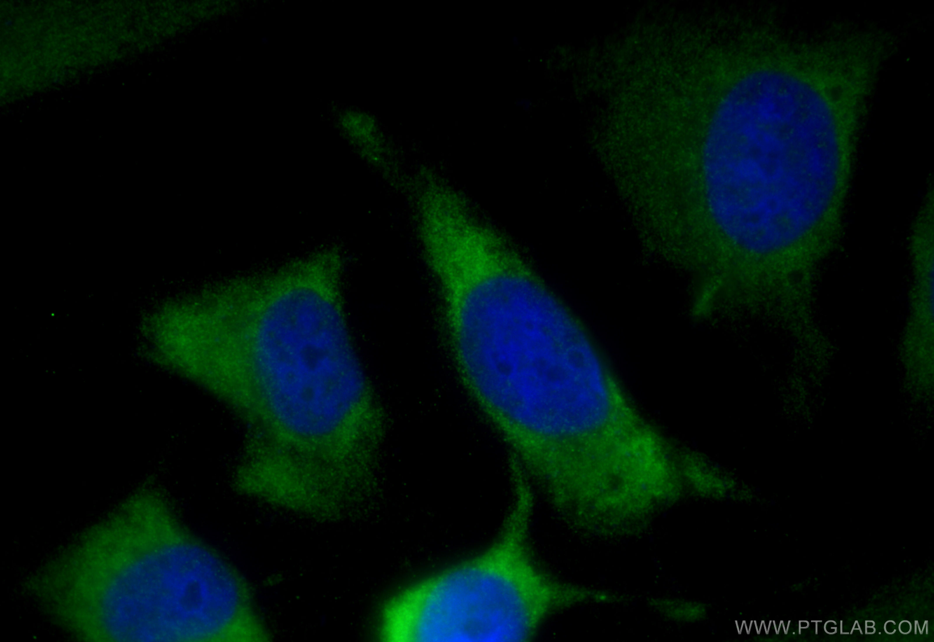 IF Staining of HeLa using 16156-1-AP