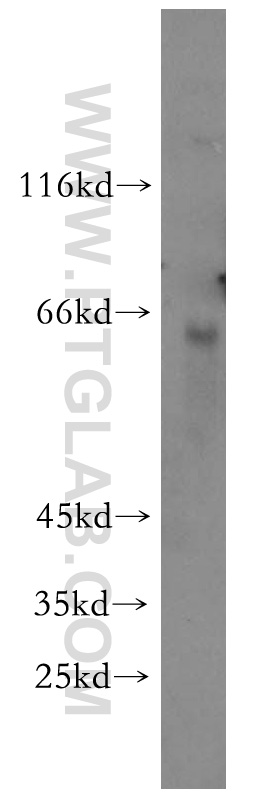 WB analysis of mouse liver using 10386-1-AP