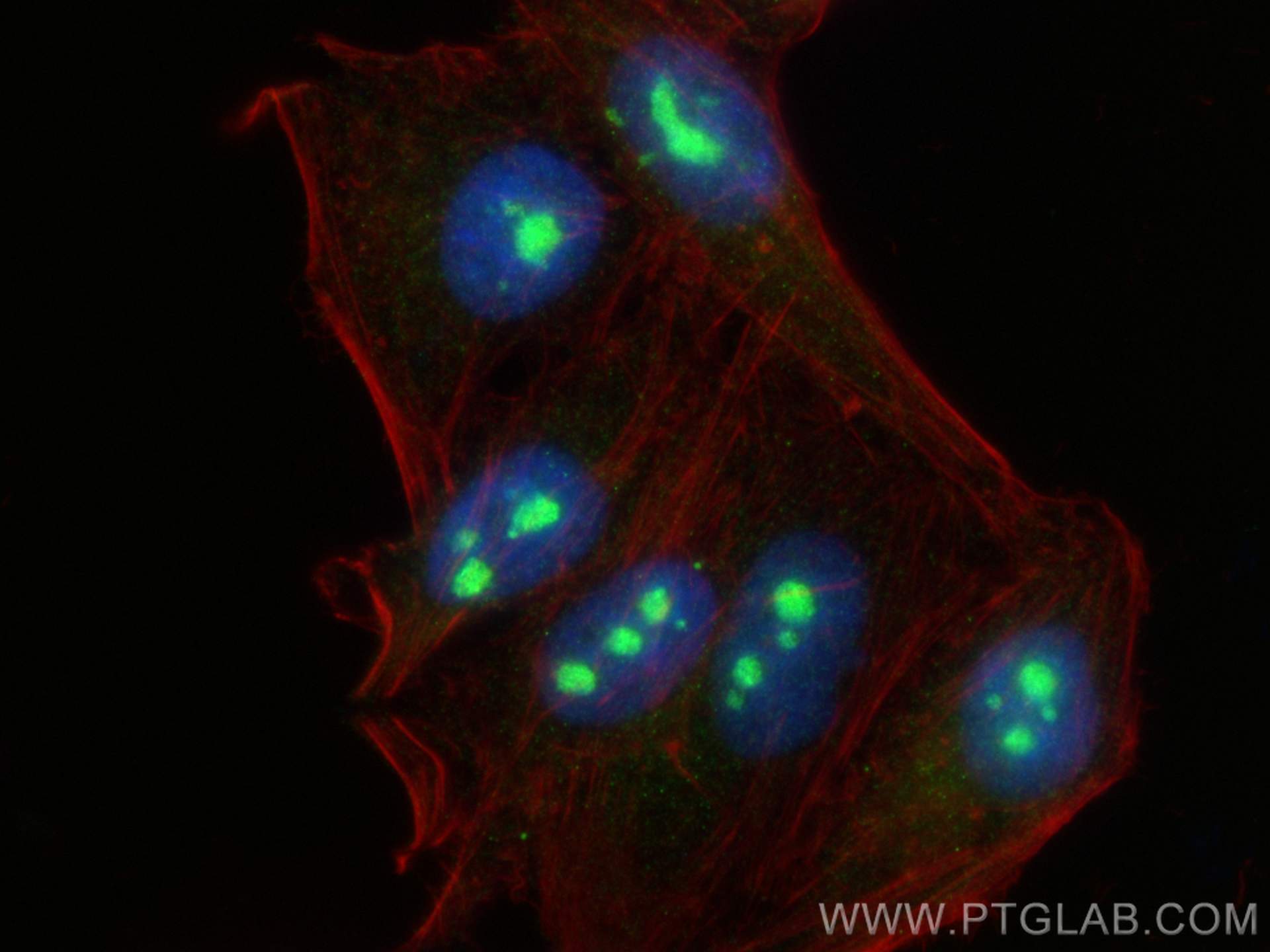 IF Staining of HepG2 using 16243-1-AP