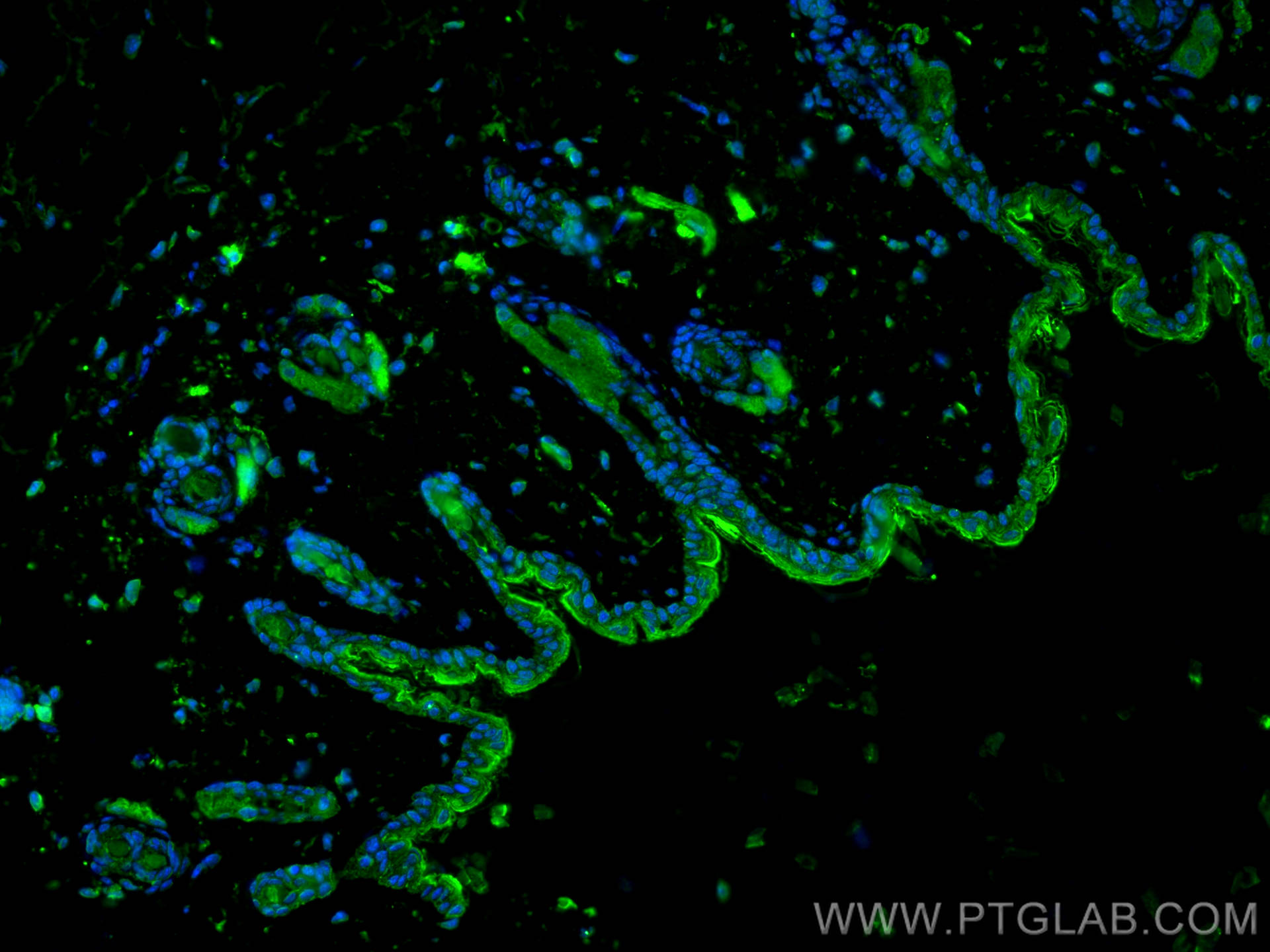 IF Staining of mouse skin using 16848-1-AP