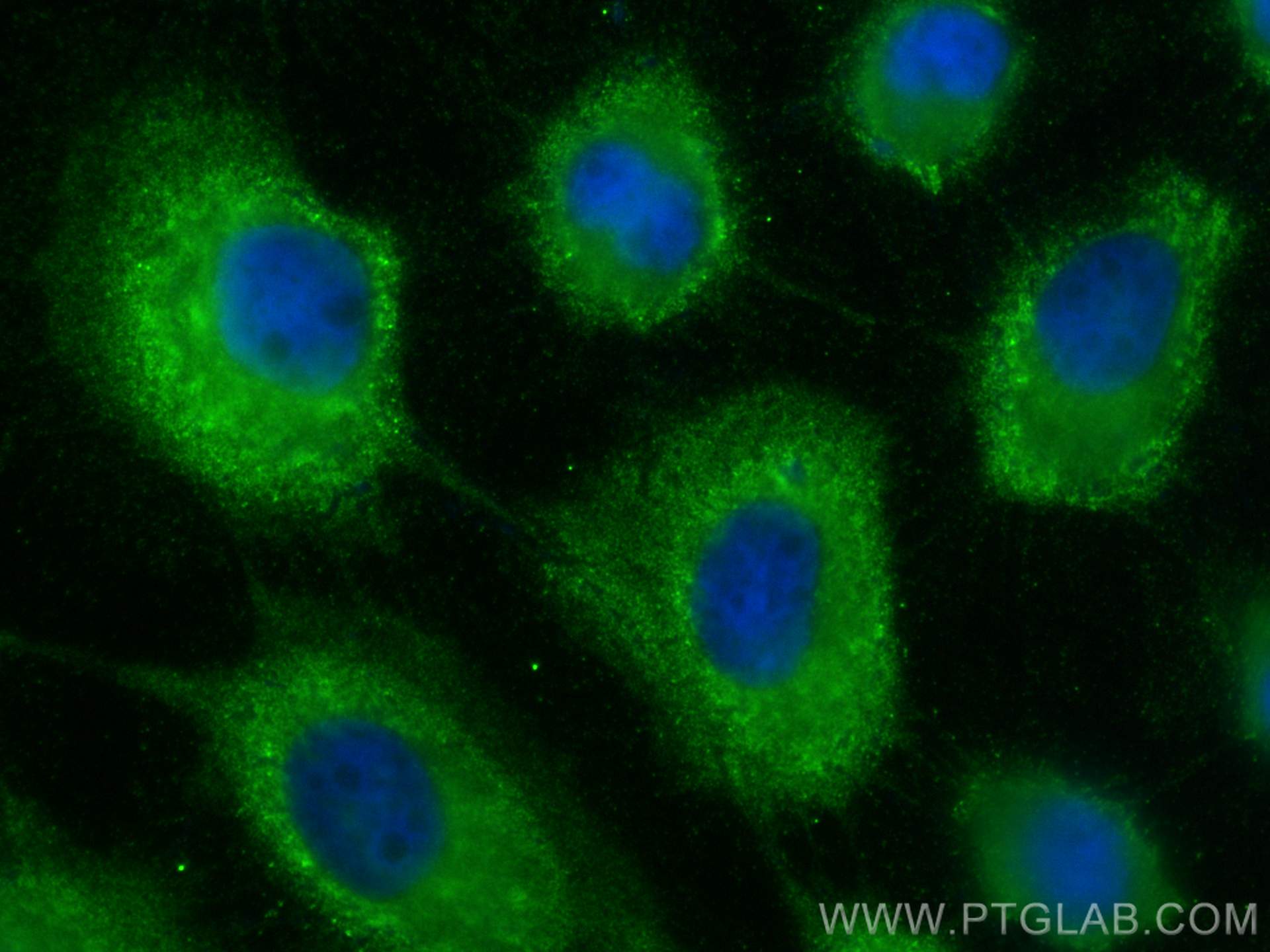 IF Staining of A431 using 16848-1-AP