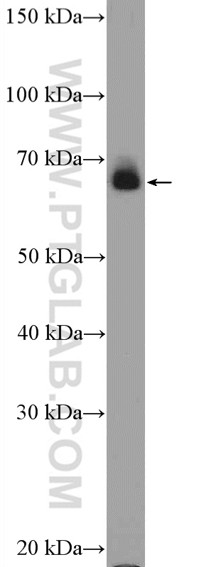 Cytokeratin 1-specific Polyclonal antibody