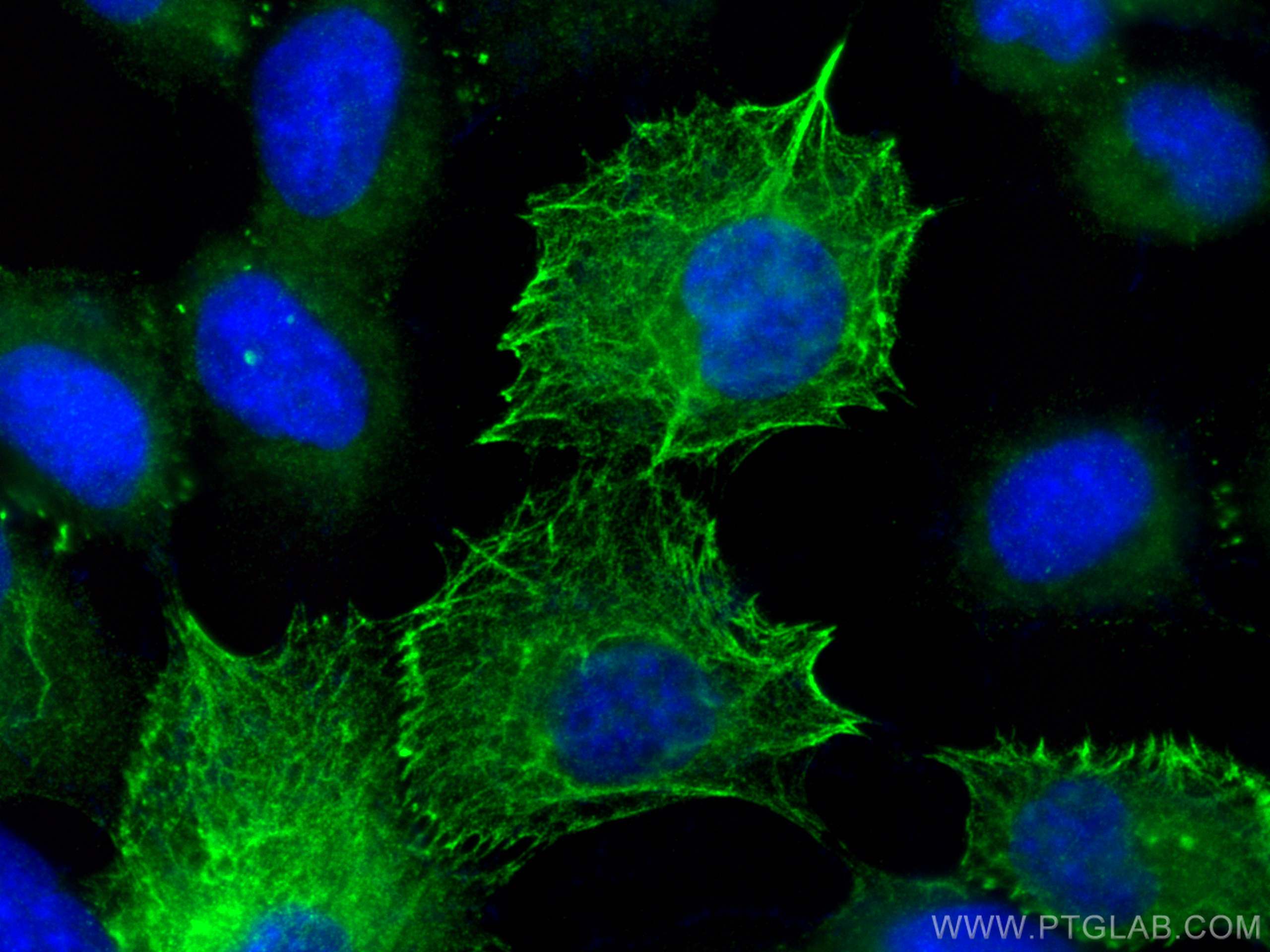 IF Staining of A431 using 18343-1-AP