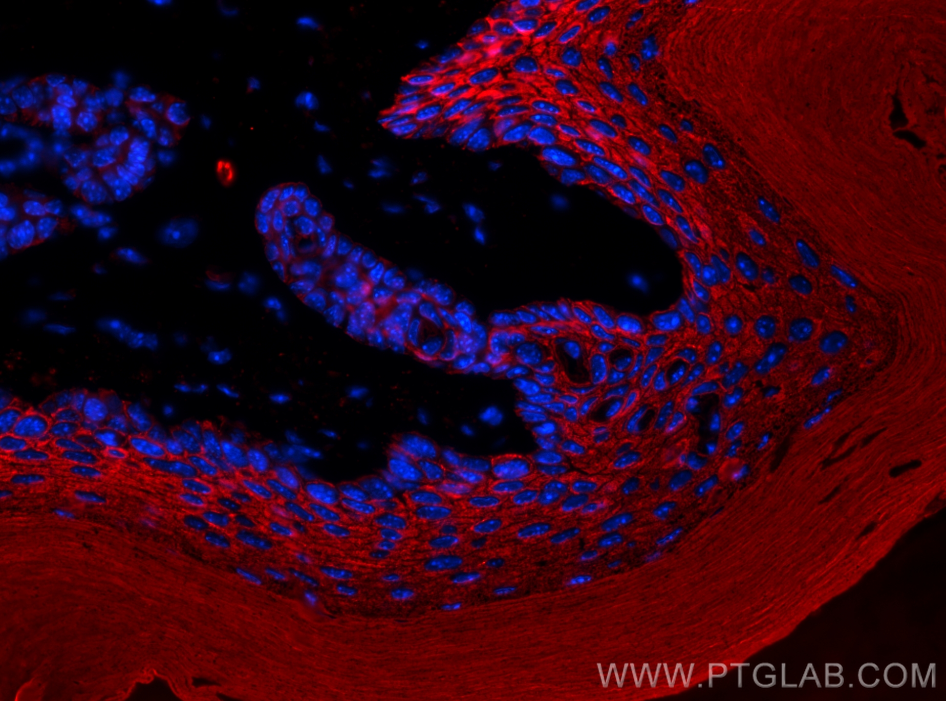 IF Staining of mouse skin using 18343-1-AP