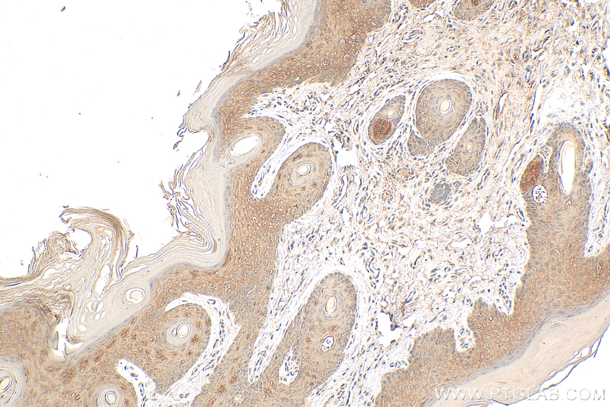 IHC staining of rat skin using 16855-1-AP