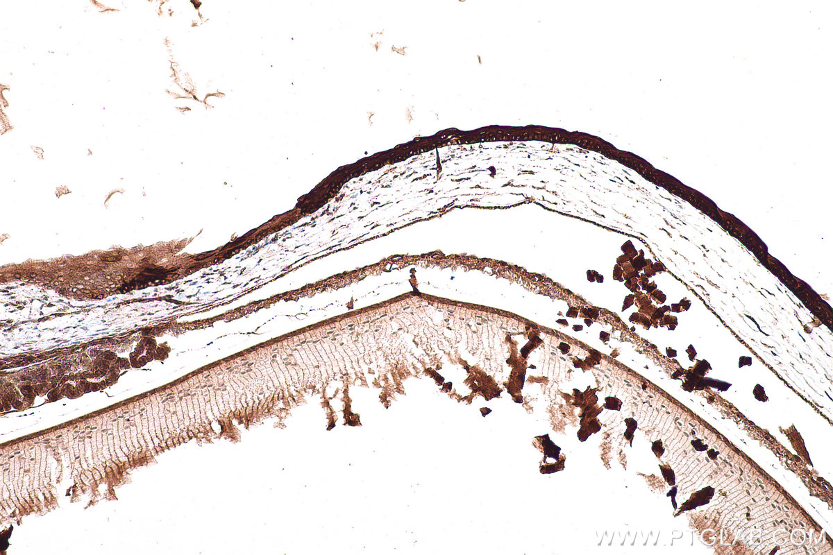 IHC staining of mouse eye using 24789-1-AP