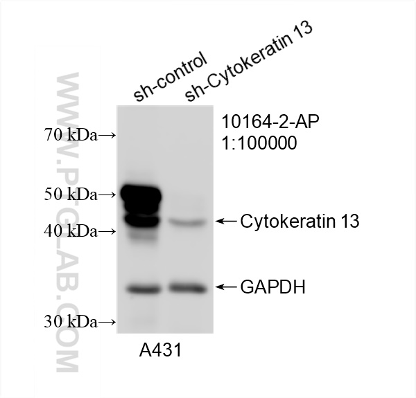 WB analysis of A431 using 10164-2-AP