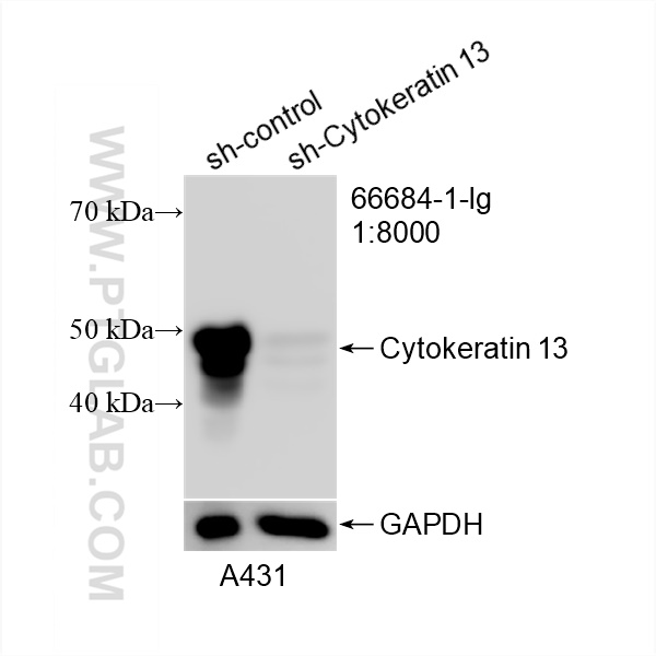 WB analysis of A431 using 66684-1-Ig