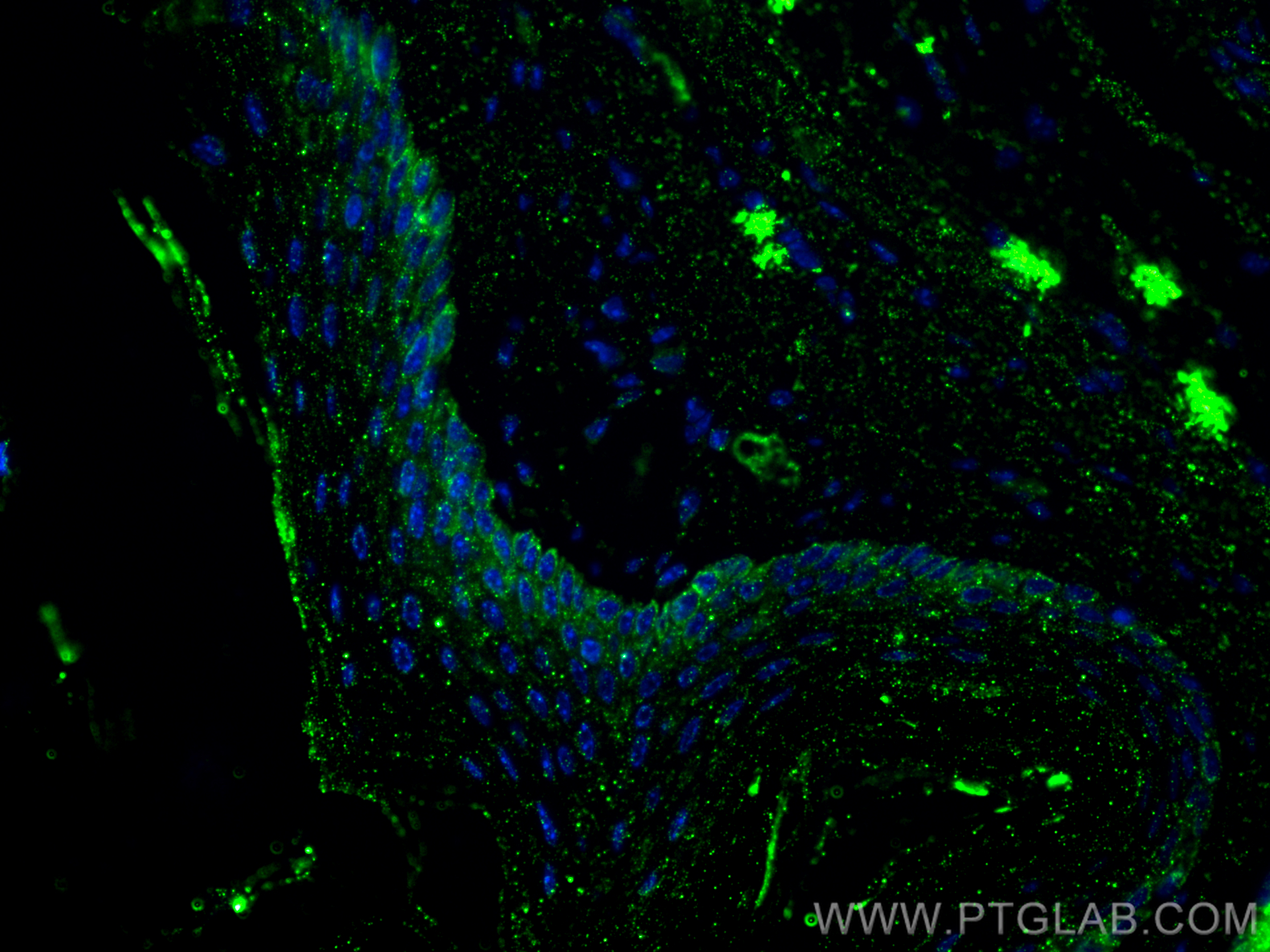 IF Staining of mouse skin using 60320-1-Ig