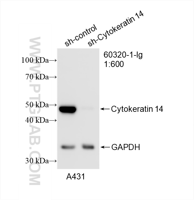 WB analysis of A431 using 60320-1-Ig