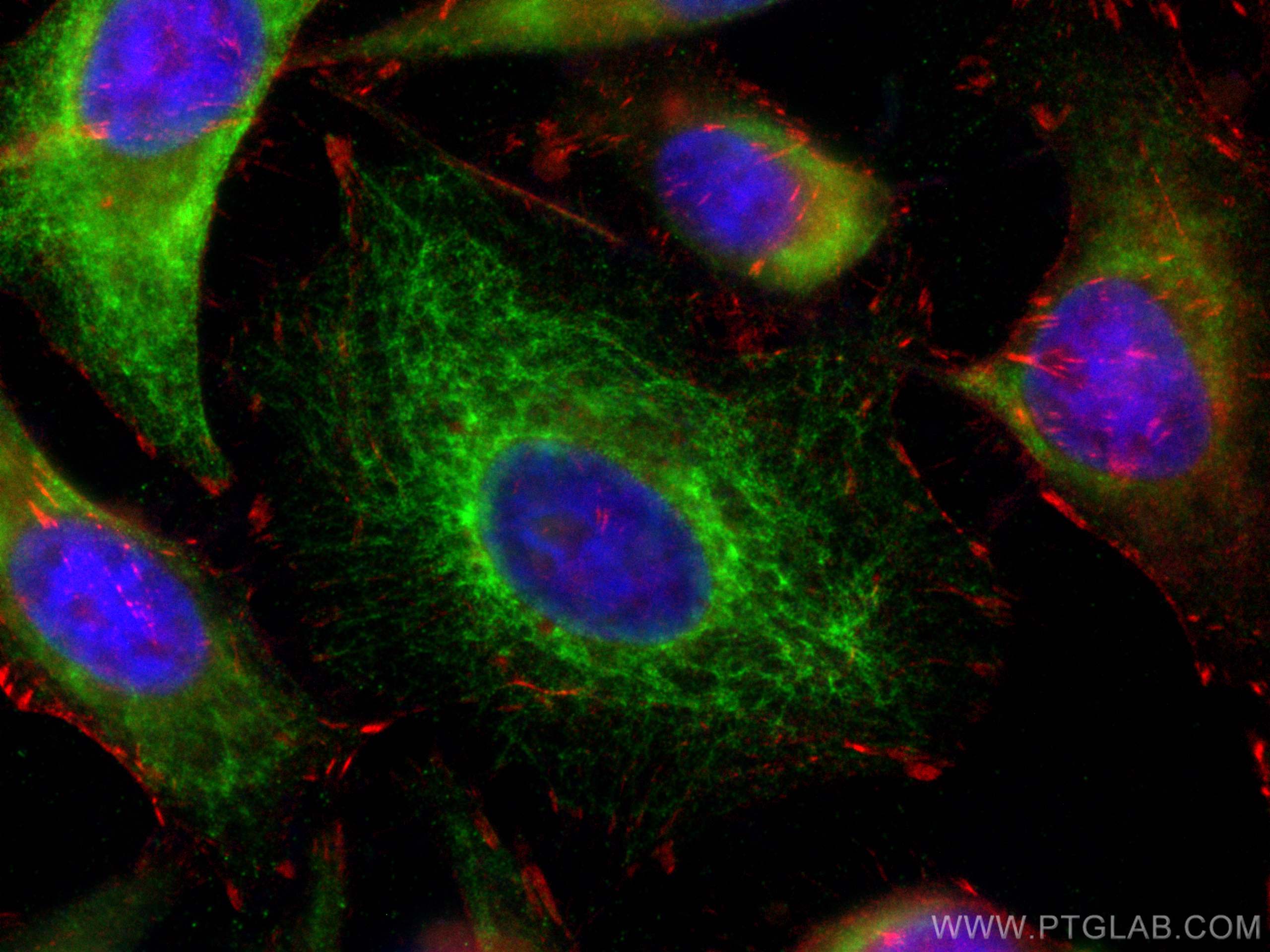 IF Staining of HeLa using 10137-1-AP