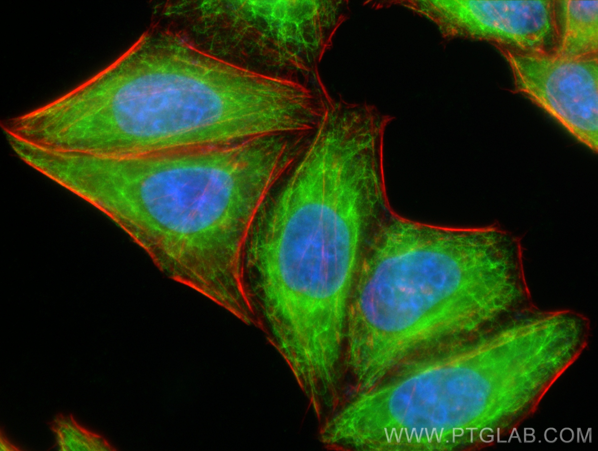 IF Staining of HepG2 using 10830-1-AP