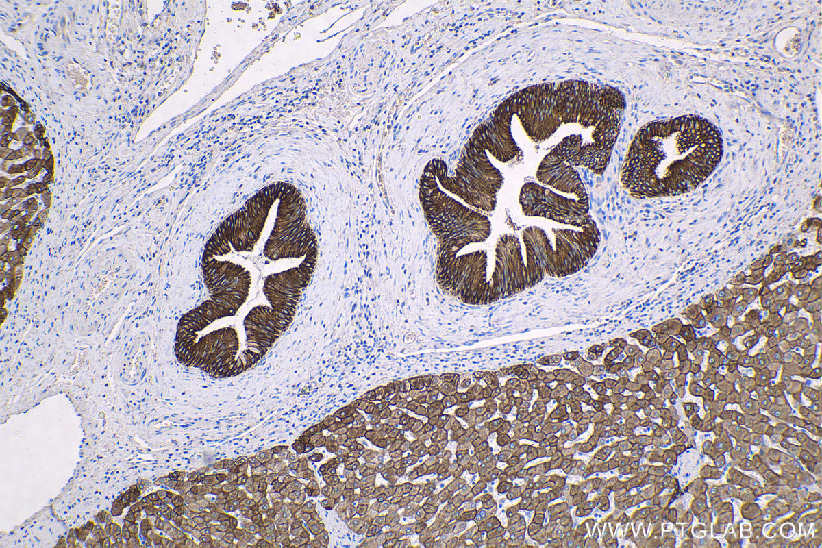 IHC staining of human liver using 66187-1-Ig