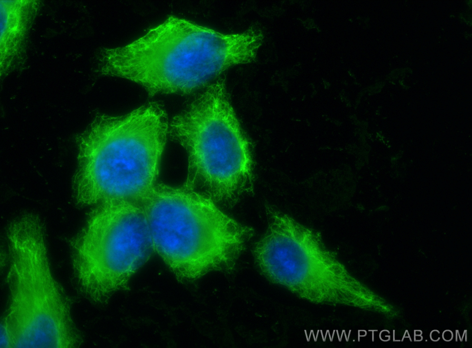 IF Staining of HepG2 using 82817-5-RR