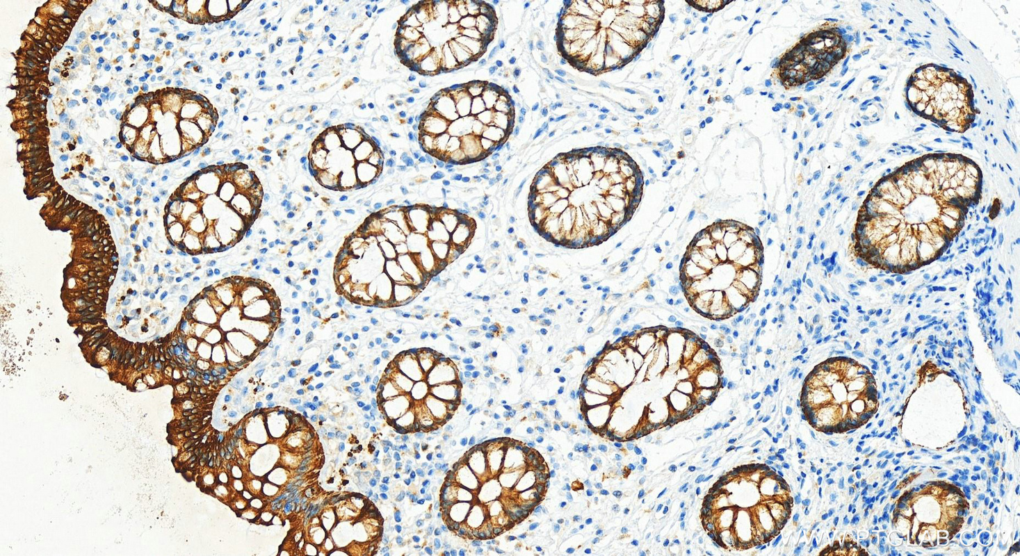 IHC staining of human colon using 10712-1-AP