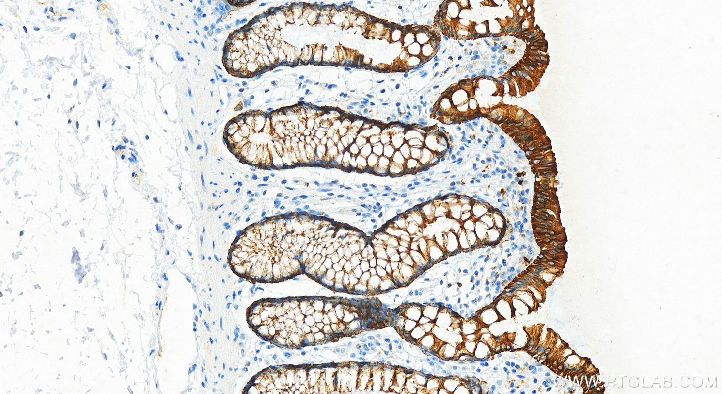 IHC staining of human colon using 10712-1-AP