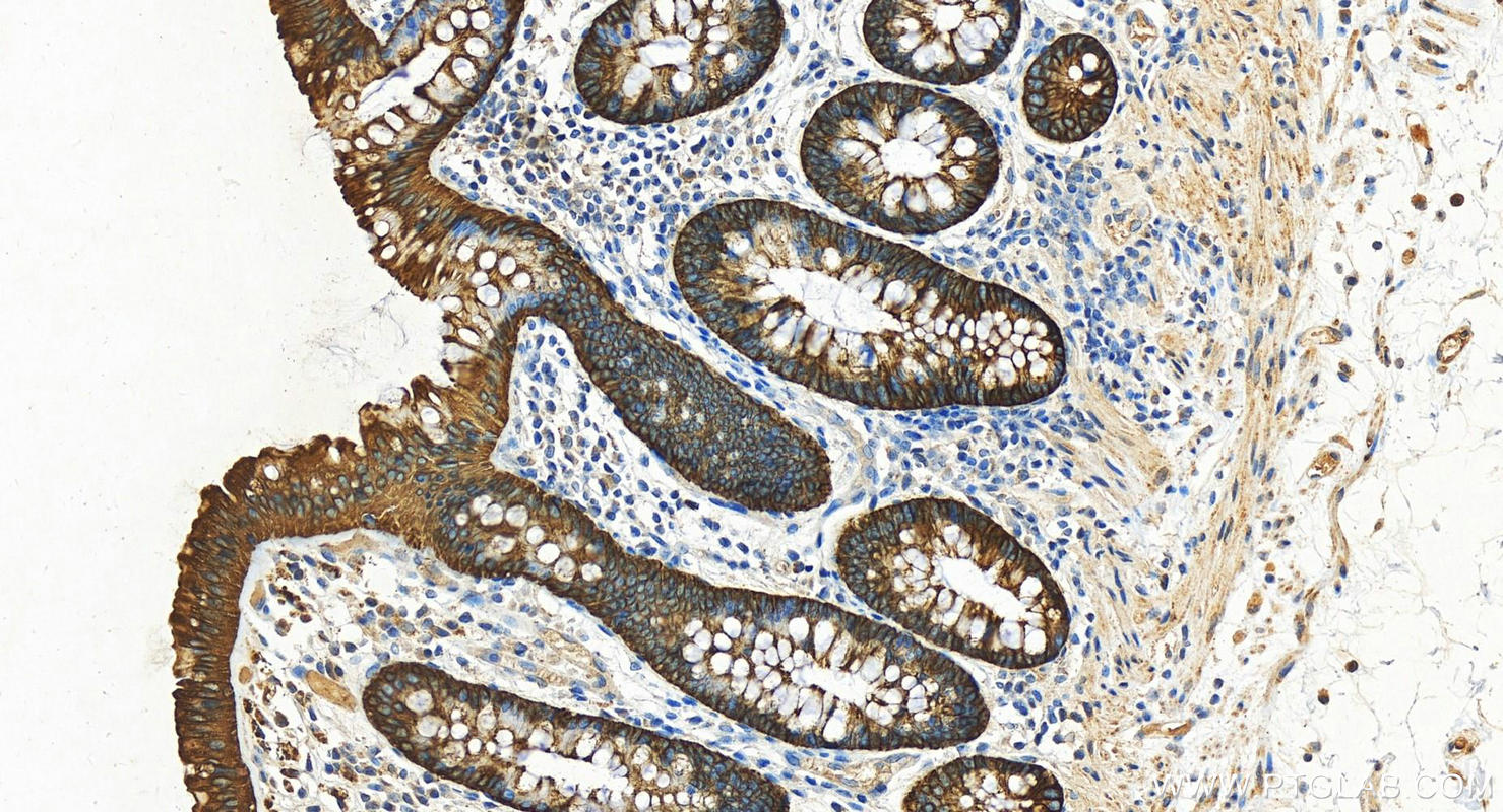 IHC staining of human colon using 14965-1-AP