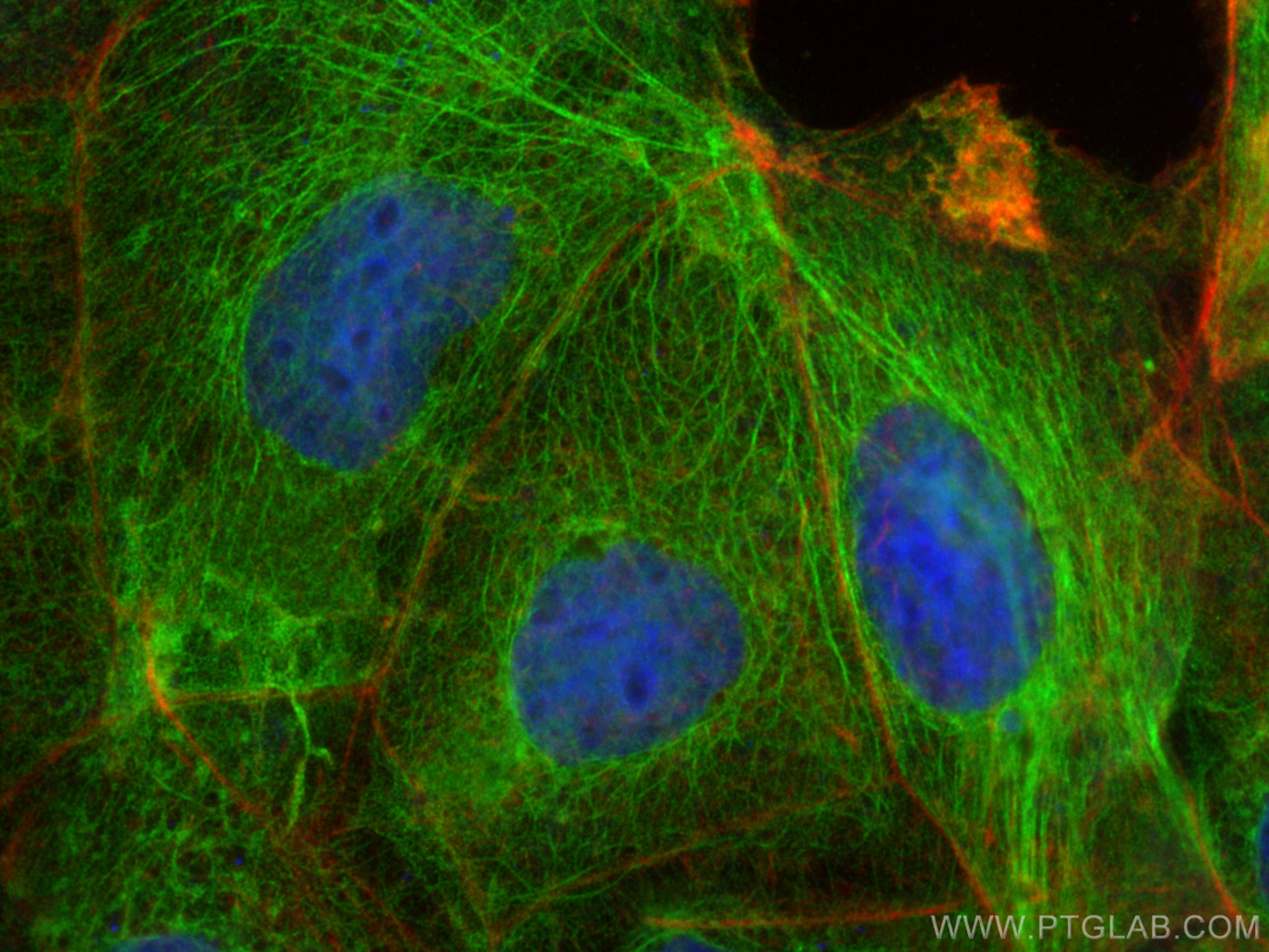 IF Staining of Caco-2 using 17329-1-AP