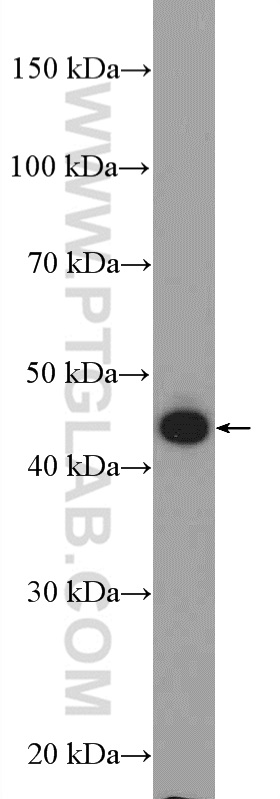 WB analysis of HeLa using 20449-1-AP