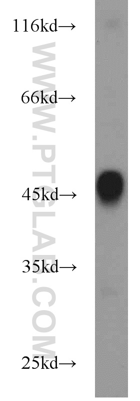 WB analysis of mouse skin using 14309-1-AP