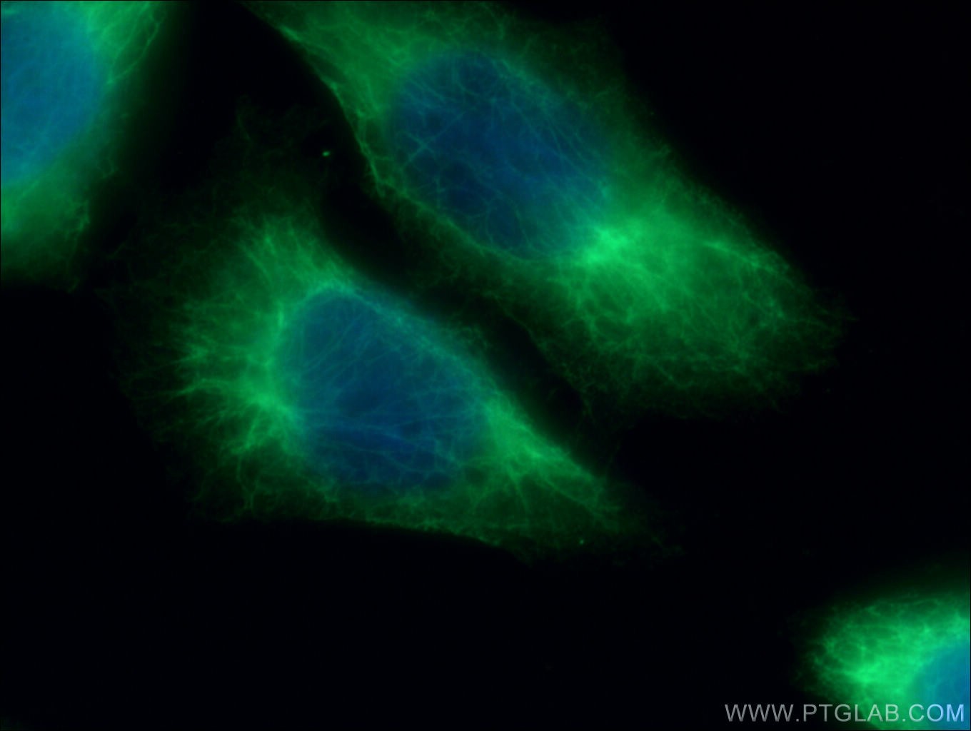 Cytokeratin 6B